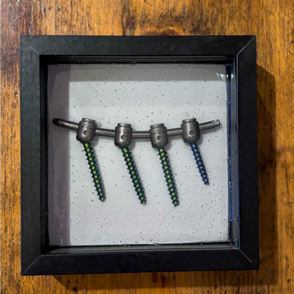 Framed Medical Art With Spine Surgery Screws
